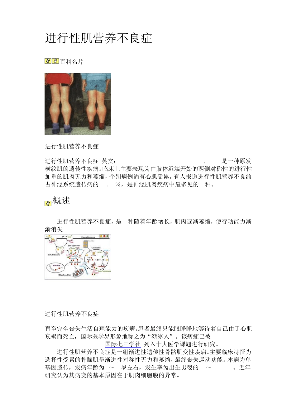 进行性肌营养不良症_第1页