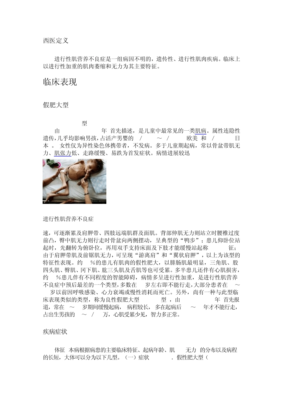 进行性肌营养不良症_第2页