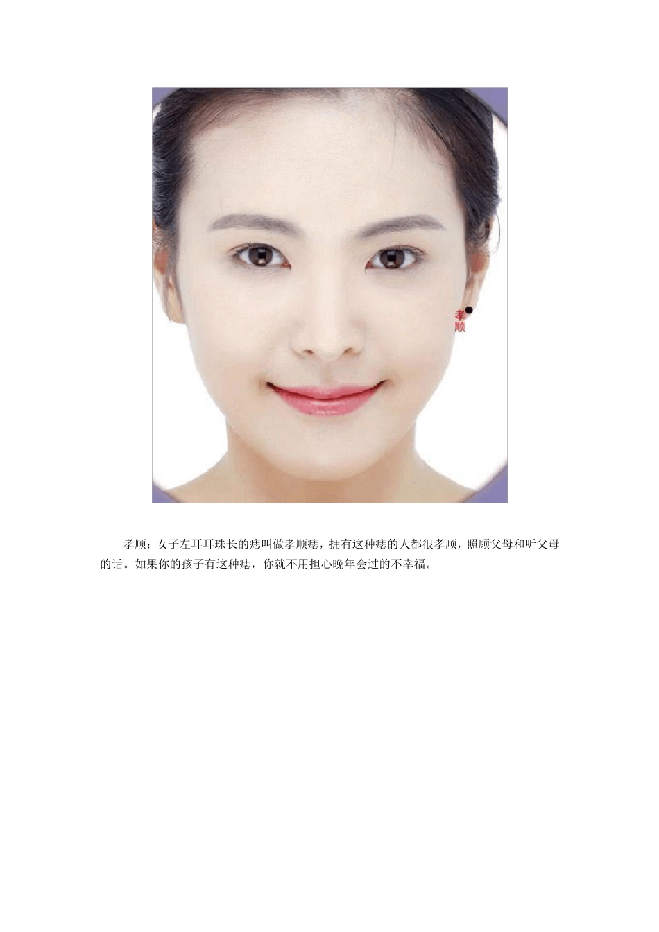 透析女性脸上的痣_第3页