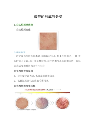 痘痘的形成与分类以及解决方法