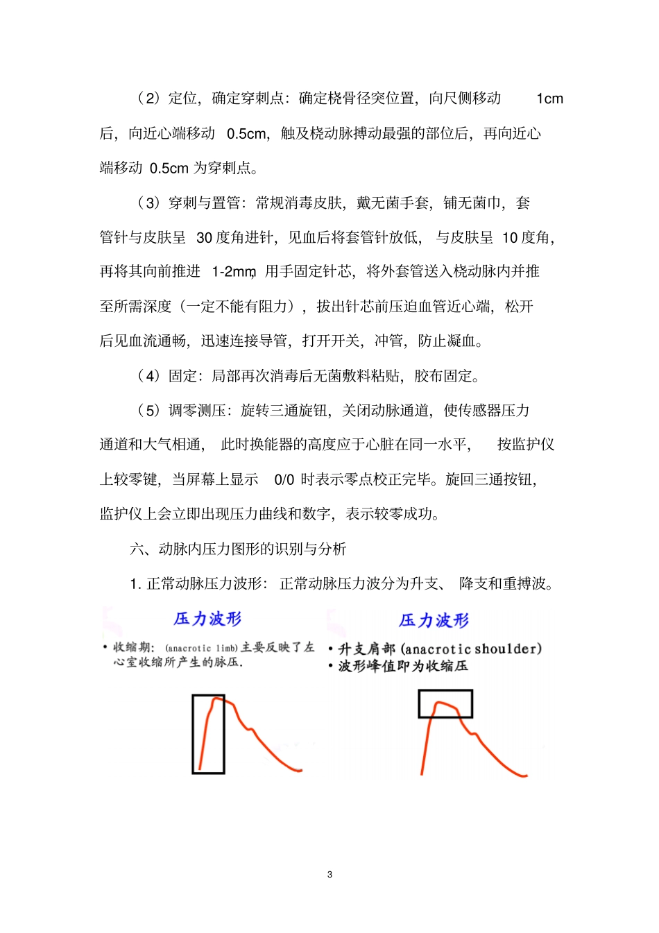 有创血压监测护理常规_第3页