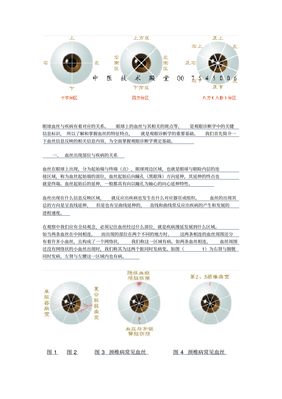 望诊奇葩——眼球血丝断病法要领_第2页