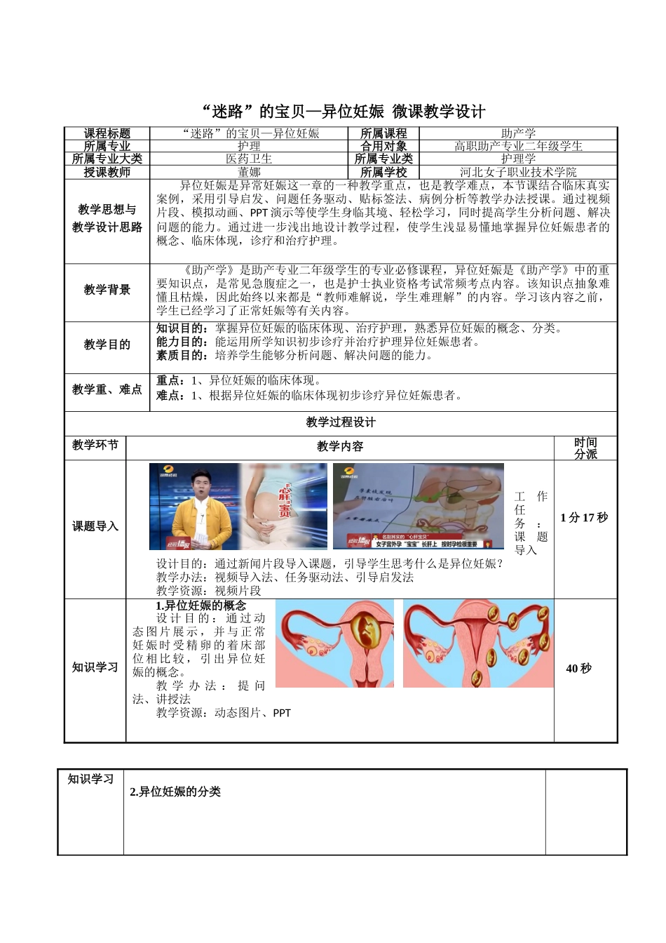 2025年异位妊娠教学设计_第2页