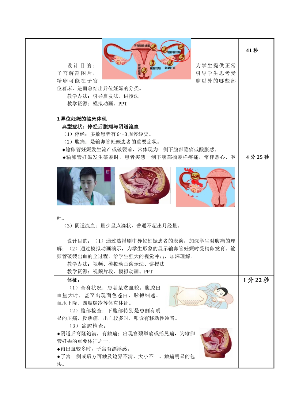2025年异位妊娠教学设计_第3页