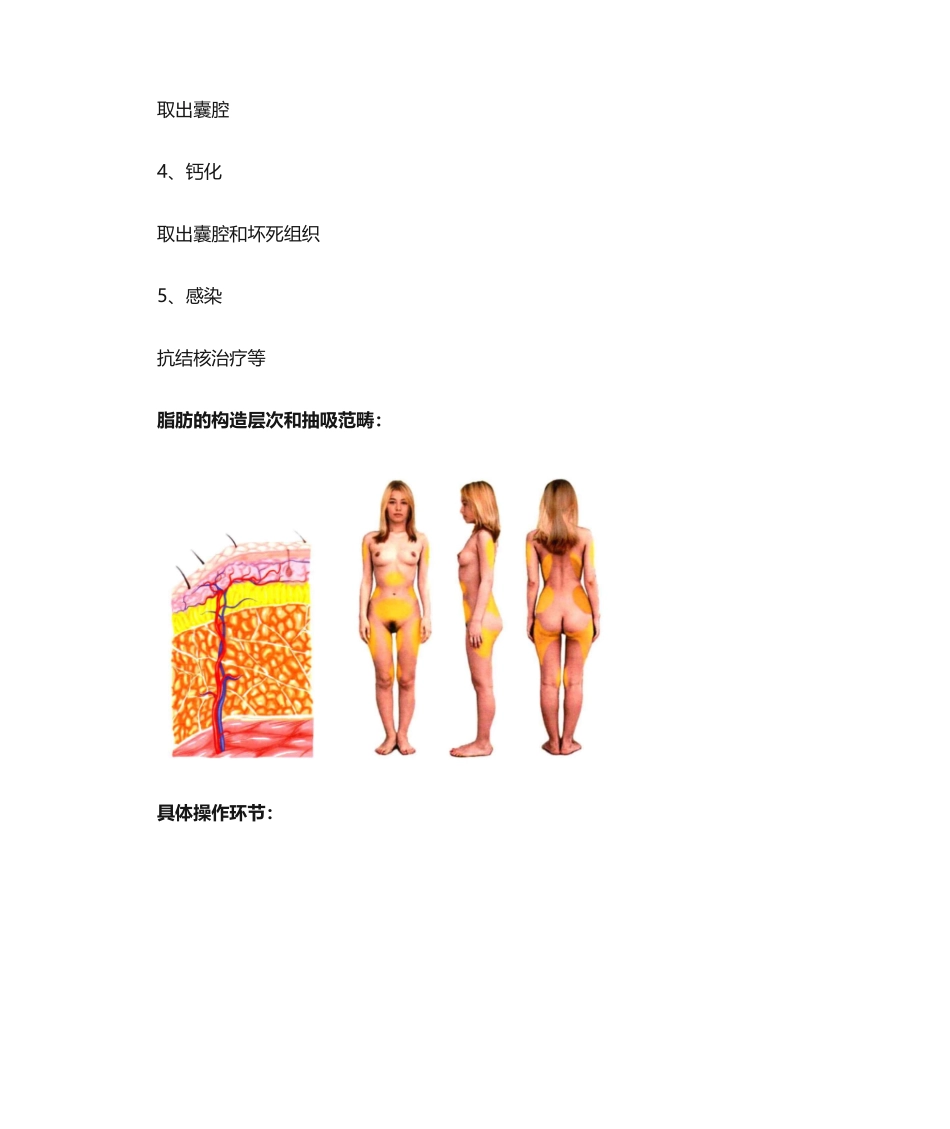 2025年脂肪抽吸和脂肪填充版_第3页