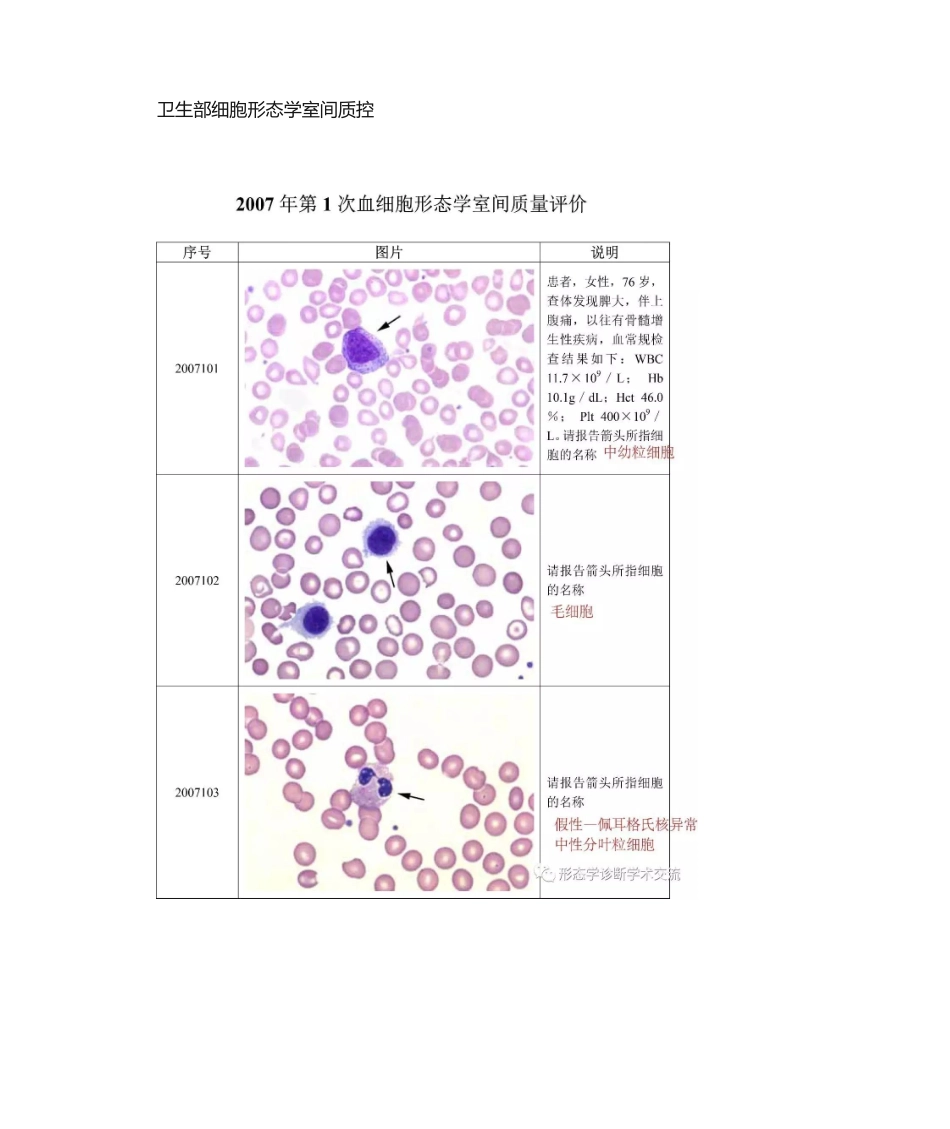 2025年卫生部血细胞形态学室间质量评价及答案_第1页
