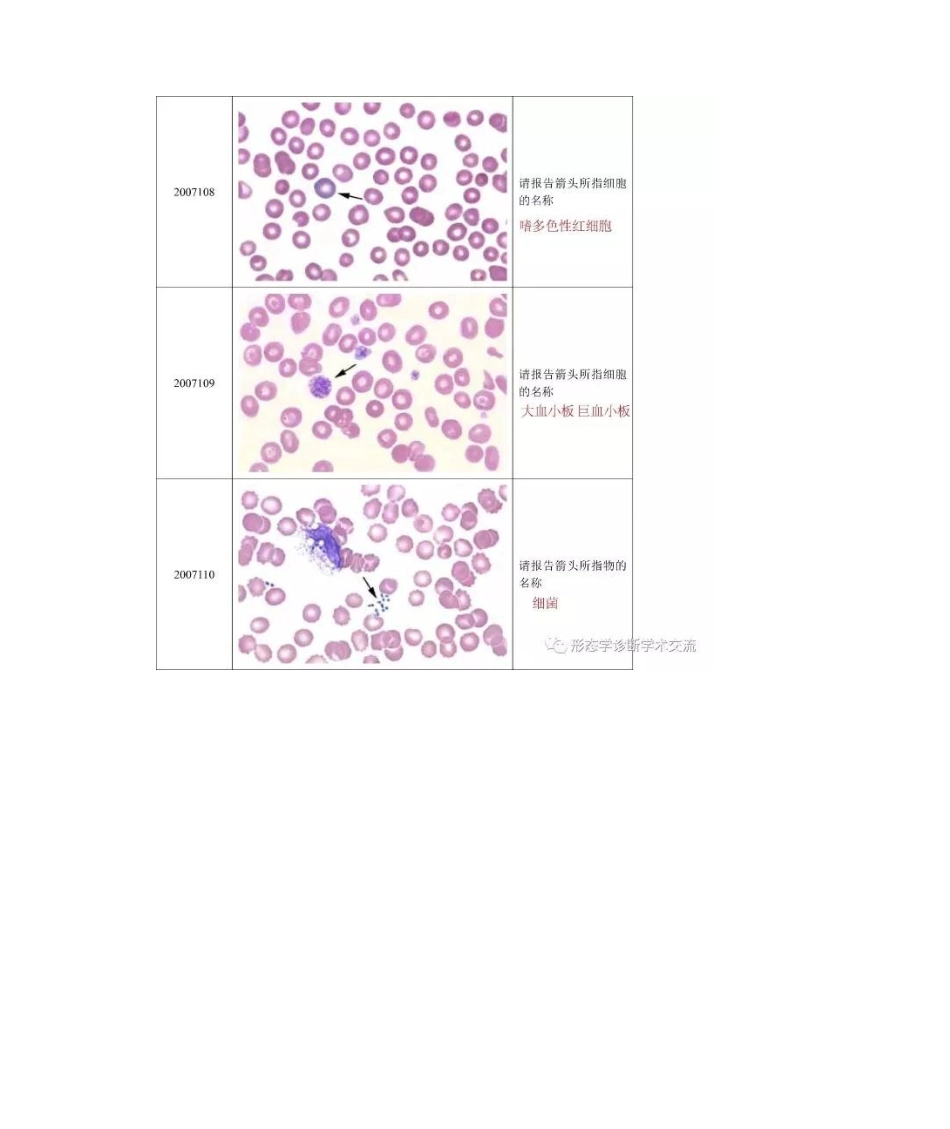 2025年卫生部血细胞形态学室间质量评价及答案_第3页