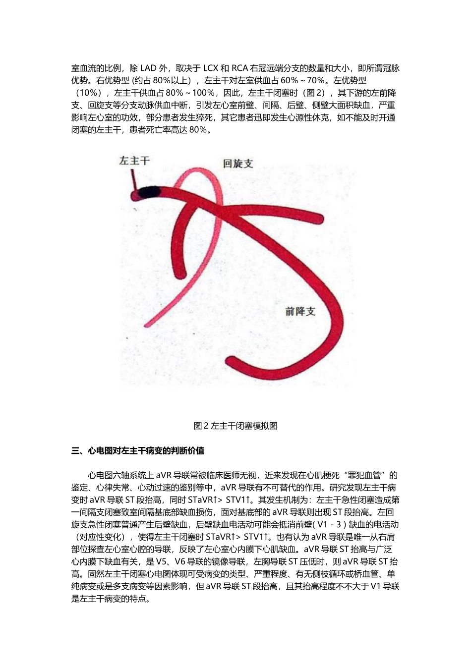 2025年左主干闭塞的心电图表现_第2页