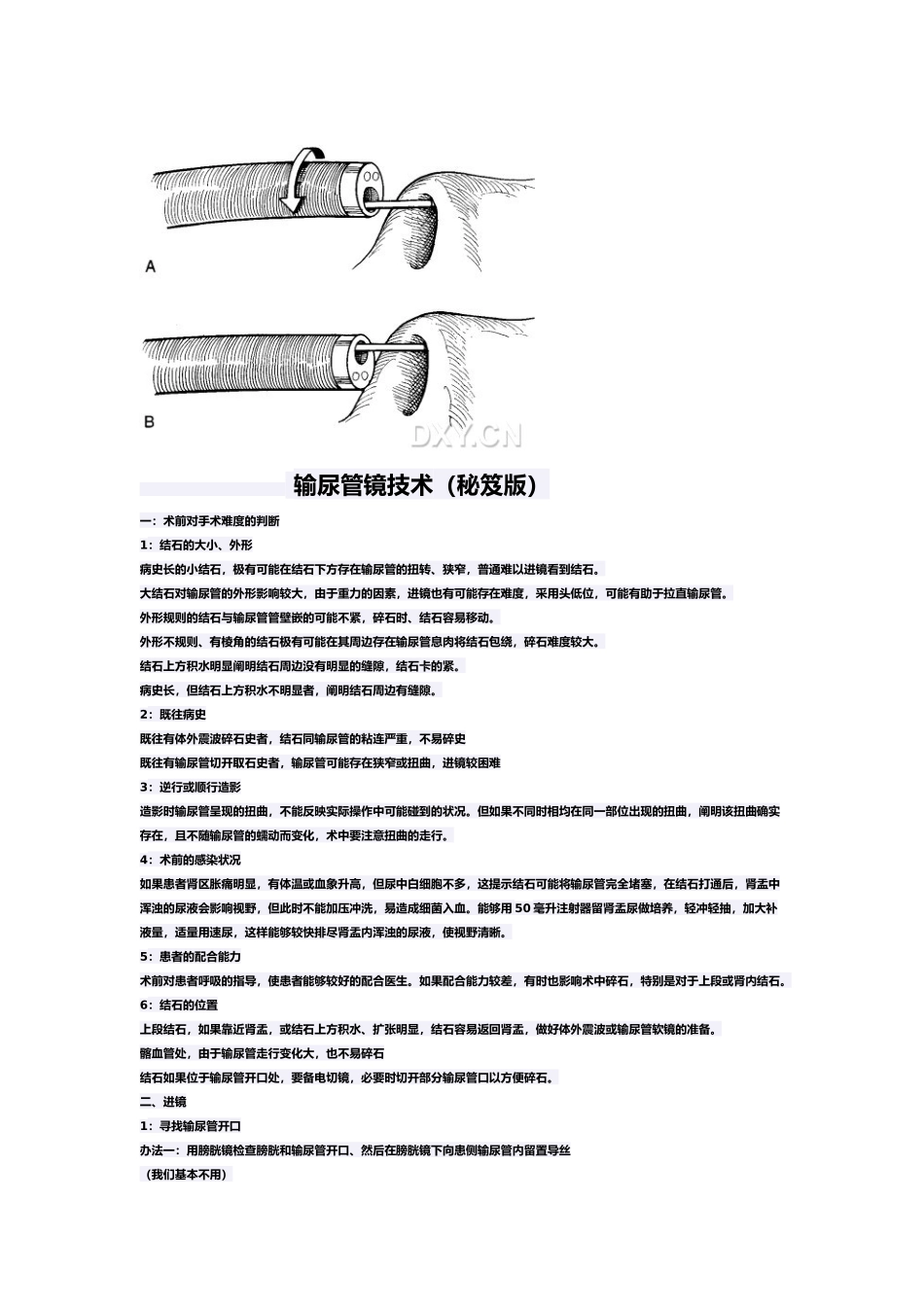 2025年输尿管镜技术_第2页