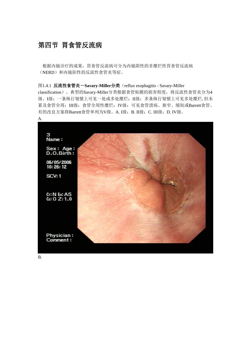 2025年消化内镜诊疗图谱胃食管反流病_第1页