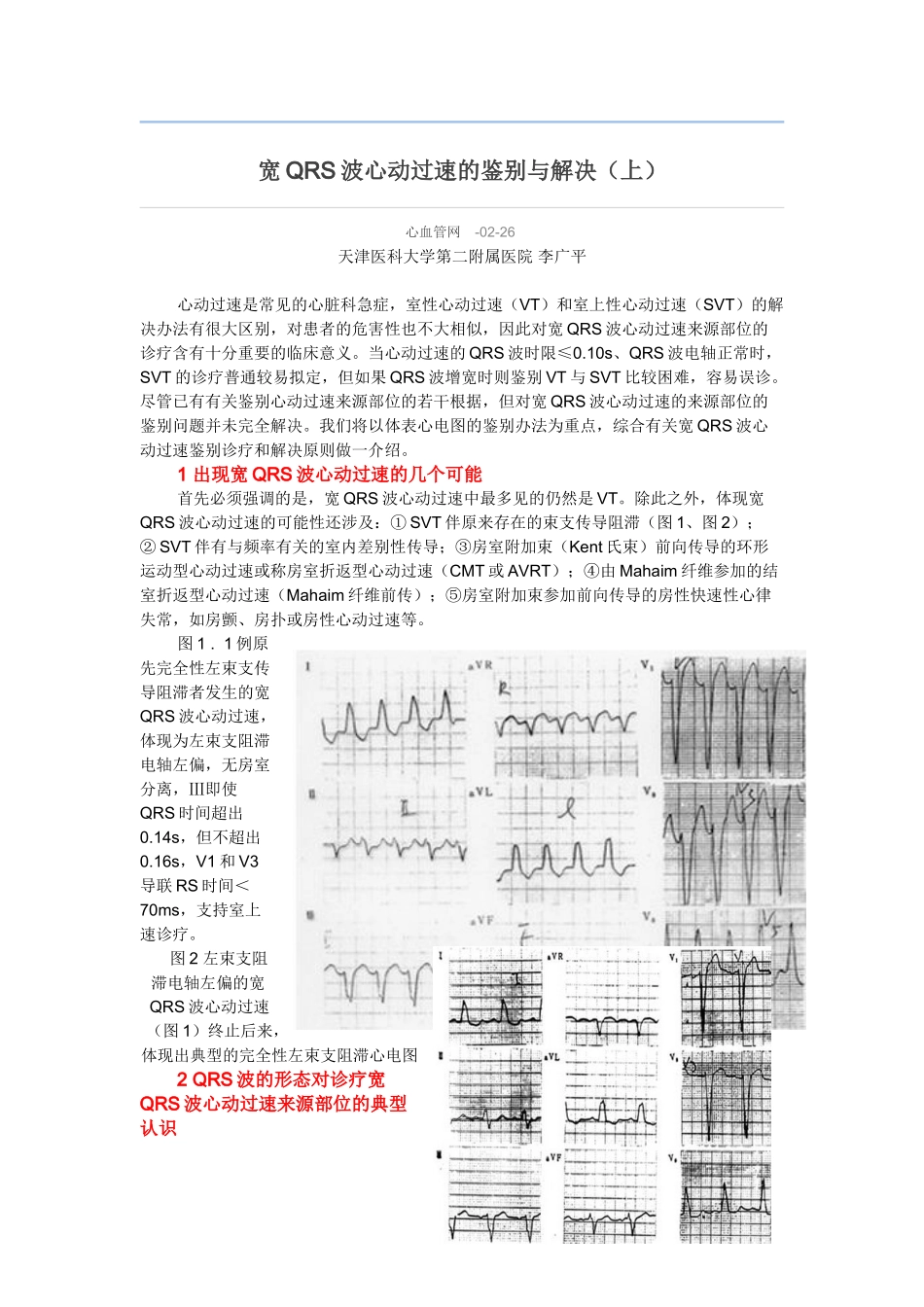 2025年宽QRS波心动过速的鉴别与处理上_第1页