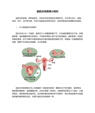 2025年盆腔炎性疾病小知识