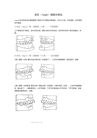 正畸错颌畸形分类图示例