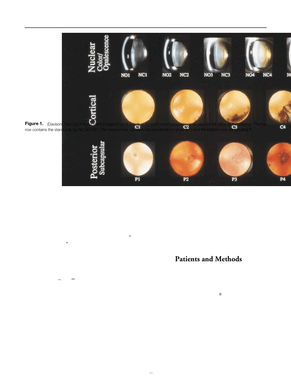 LOCSIII白内障分级权威_第2页