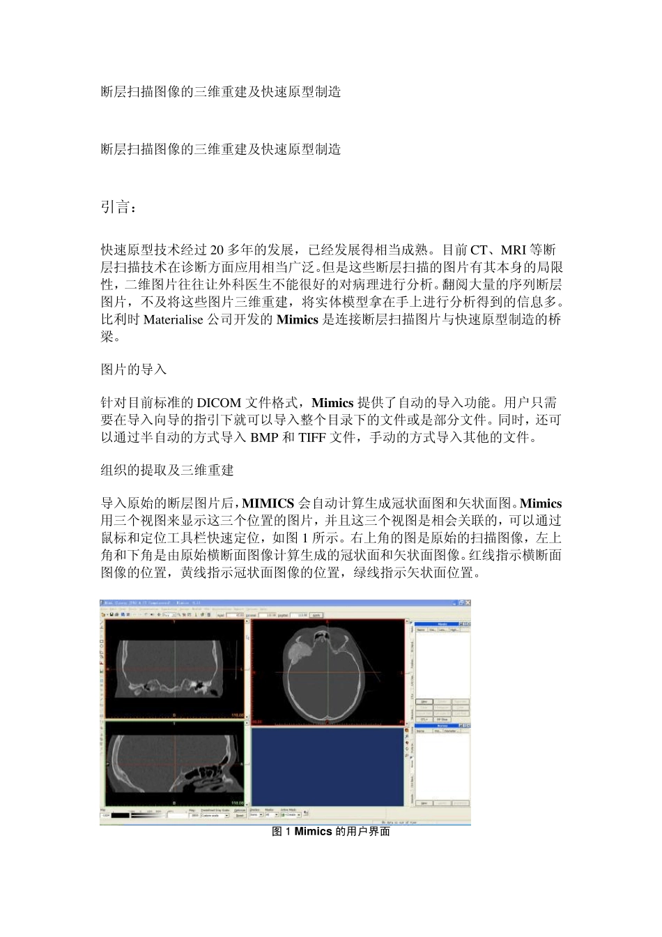 mimics实例_第1页