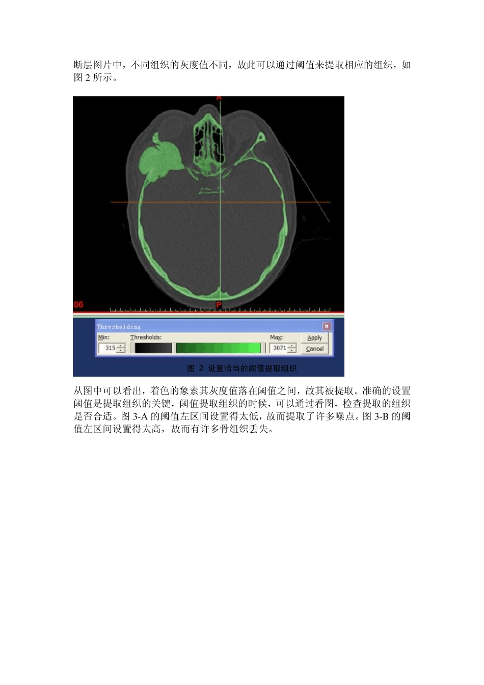 mimics实例_第2页
