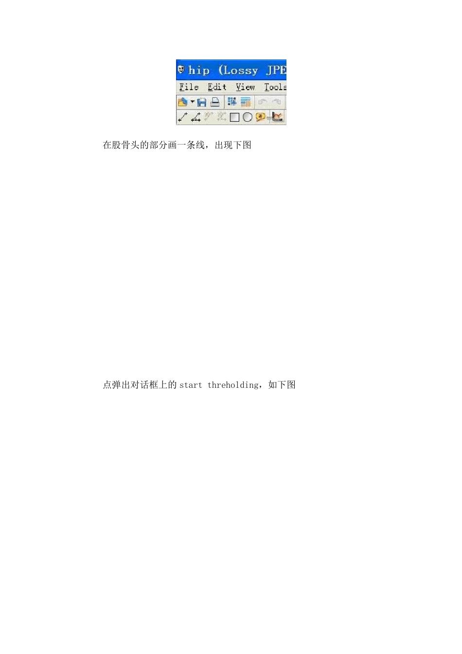 mimics建模步骤_第2页