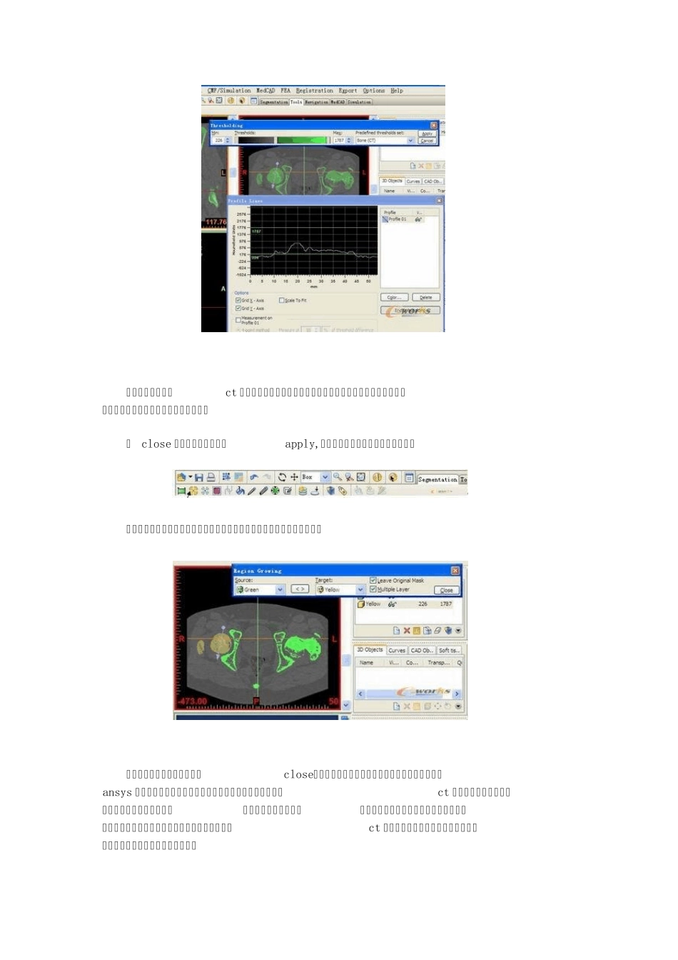 MIMICS软件在人体骨组织重建方面的应用_第3页