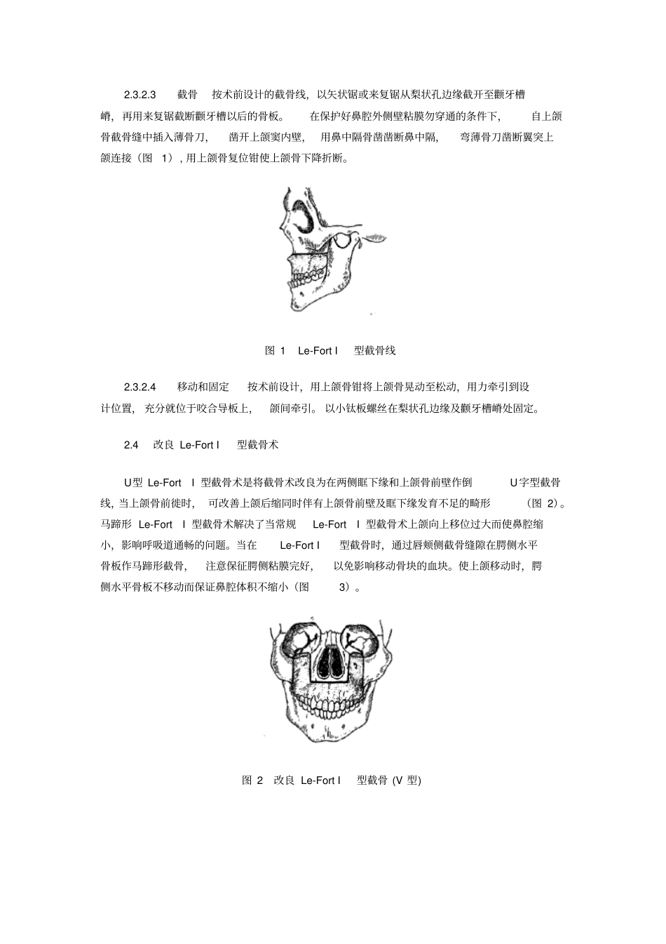正颌外科常见手术方式与适应证_第3页
