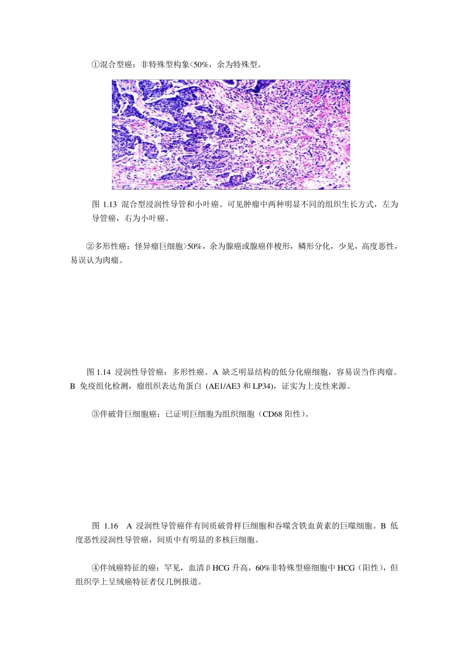 WHO乳腺肿瘤组织学分类9月1日_第2页