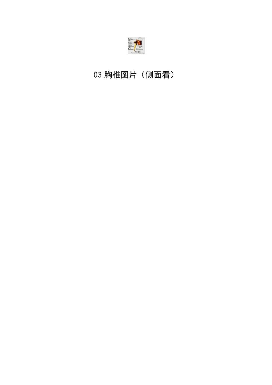 [胸椎等图解]_第3页