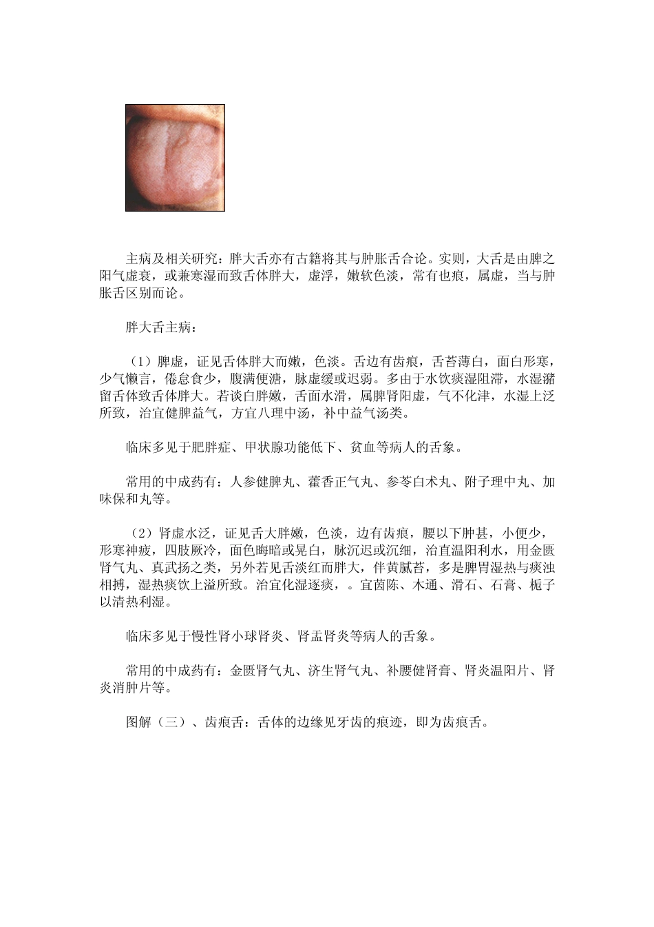 _二十三幅图图解舌诊_第3页
