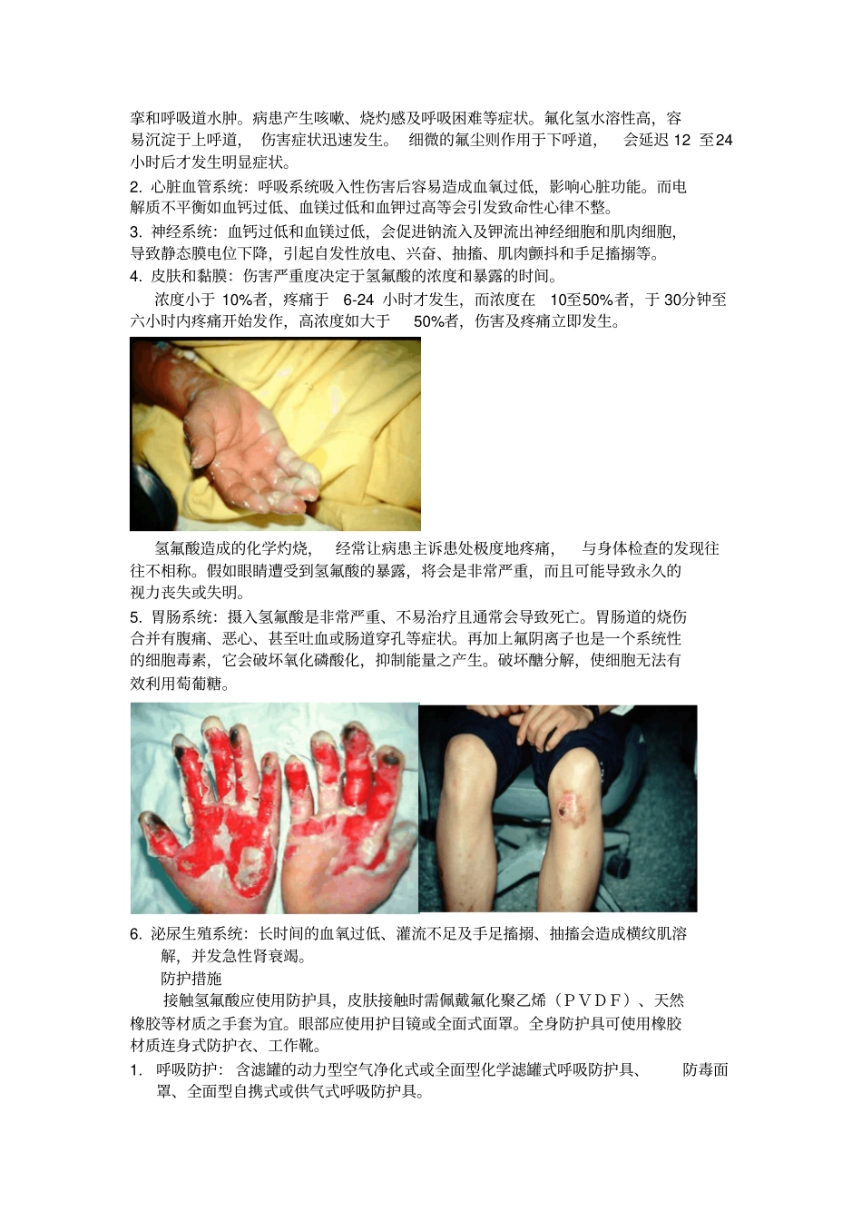 氢氟酸HF使用安全手册_第2页