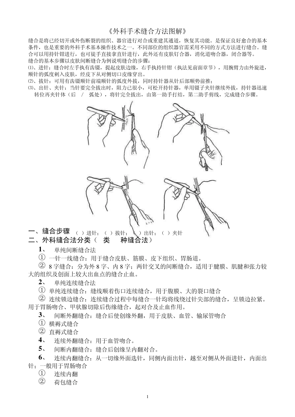 《手术缝合方法分类图解》_第1页