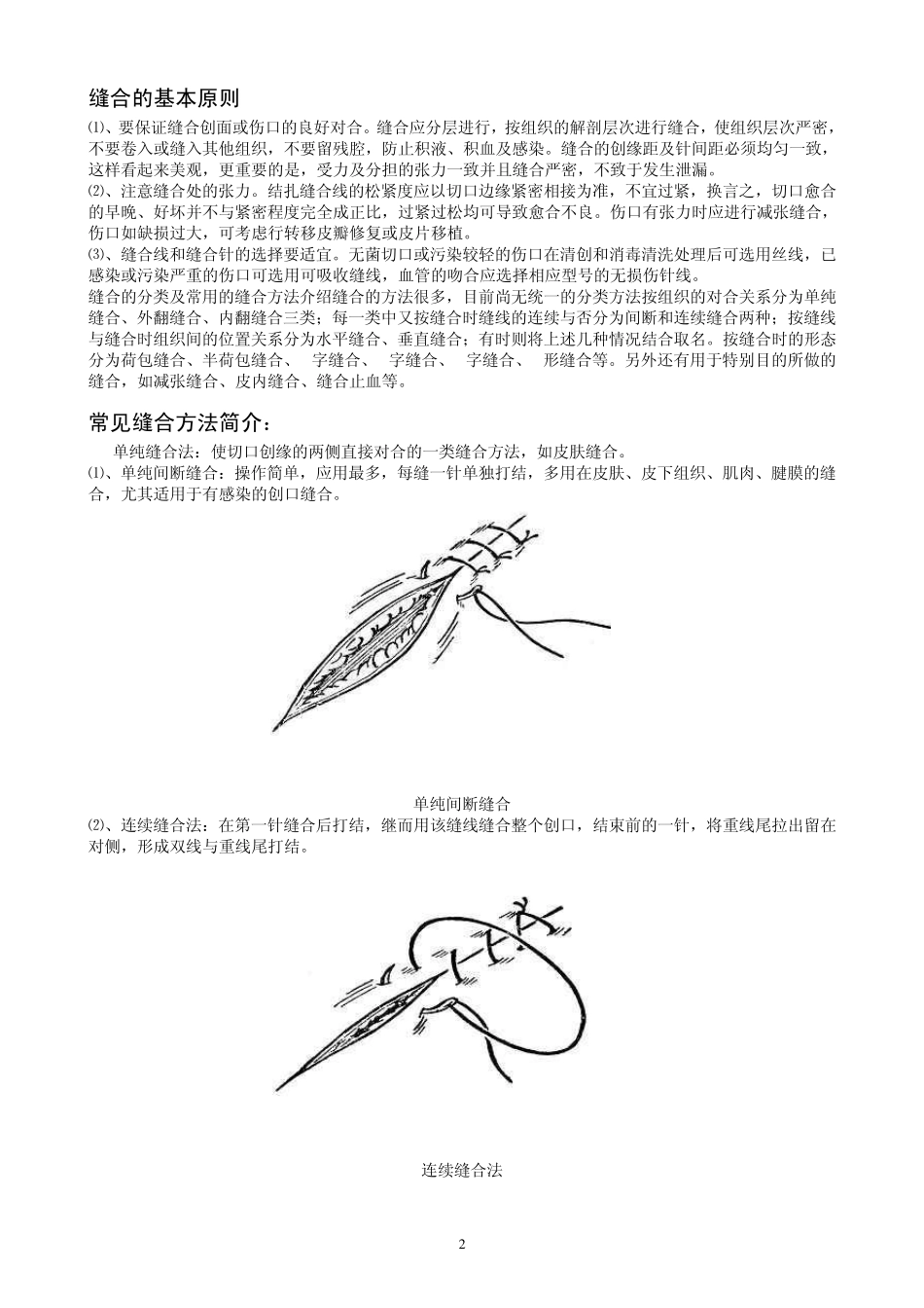 《手术缝合方法分类图解》_第2页