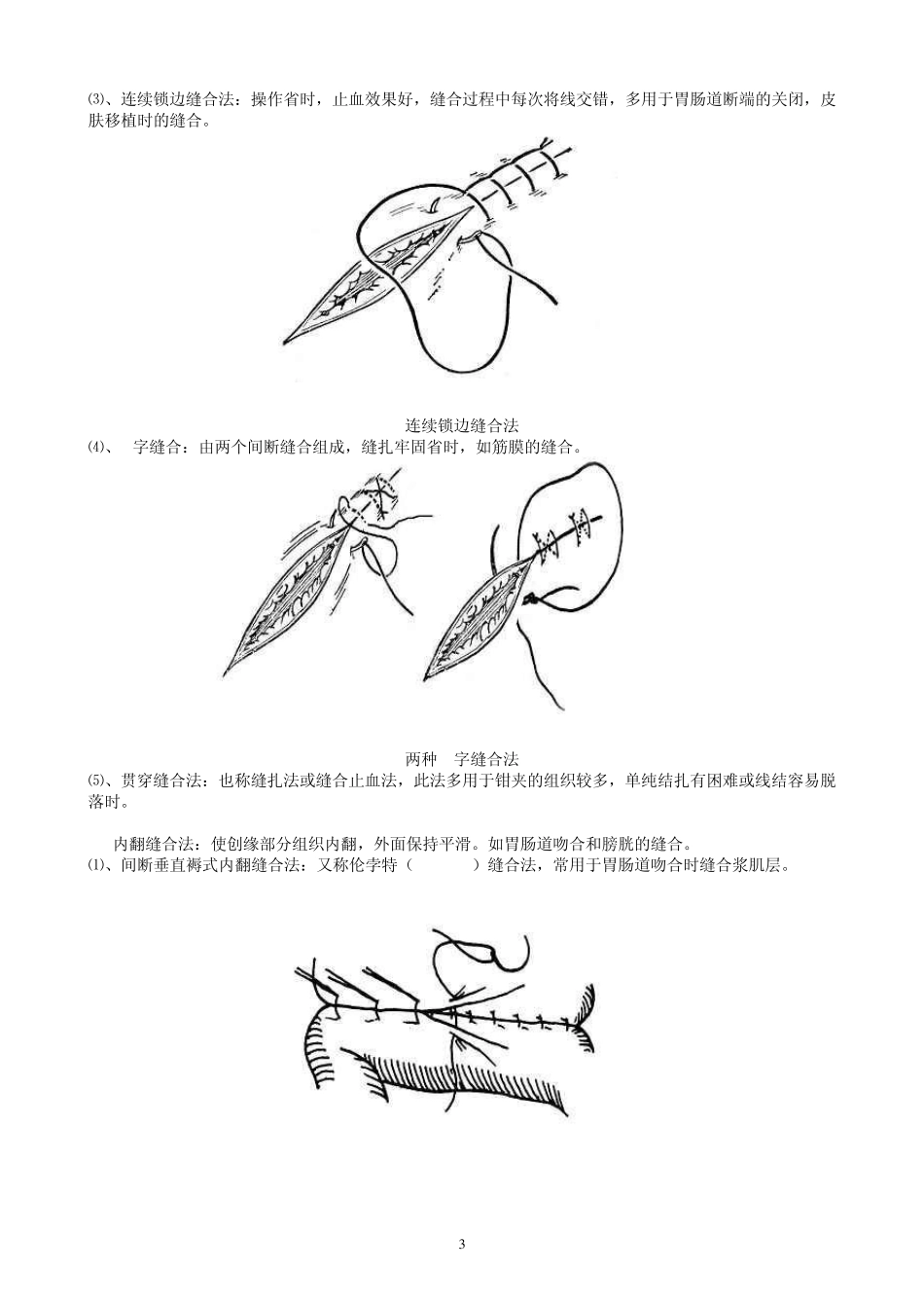 《手术缝合方法分类图解》_第3页