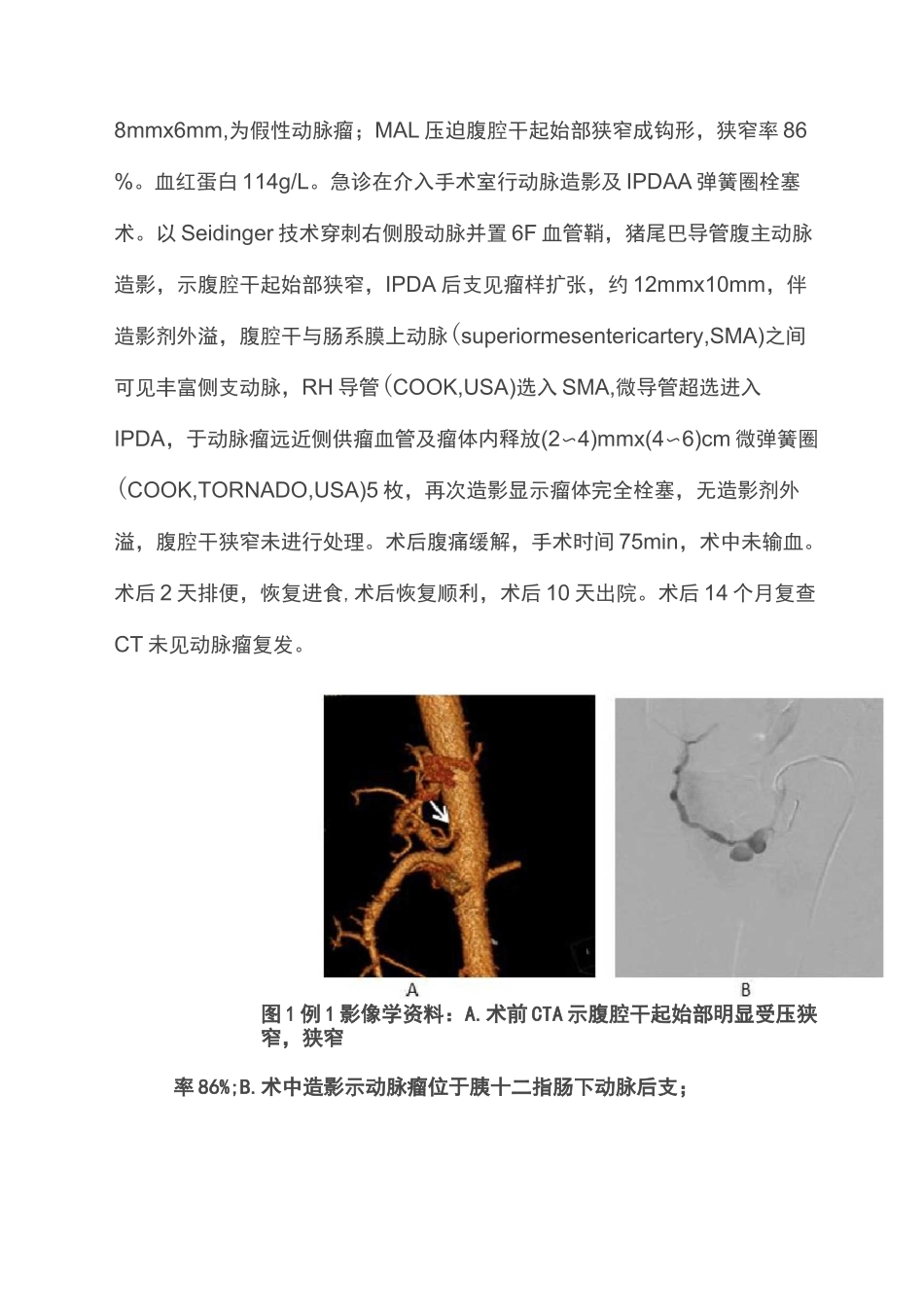 正中弓状韧带压迫合并胰十二指肠下动脉瘤诊治策略(全文)_第2页