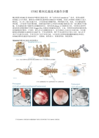 全部步骤(椎间孔镜)手术