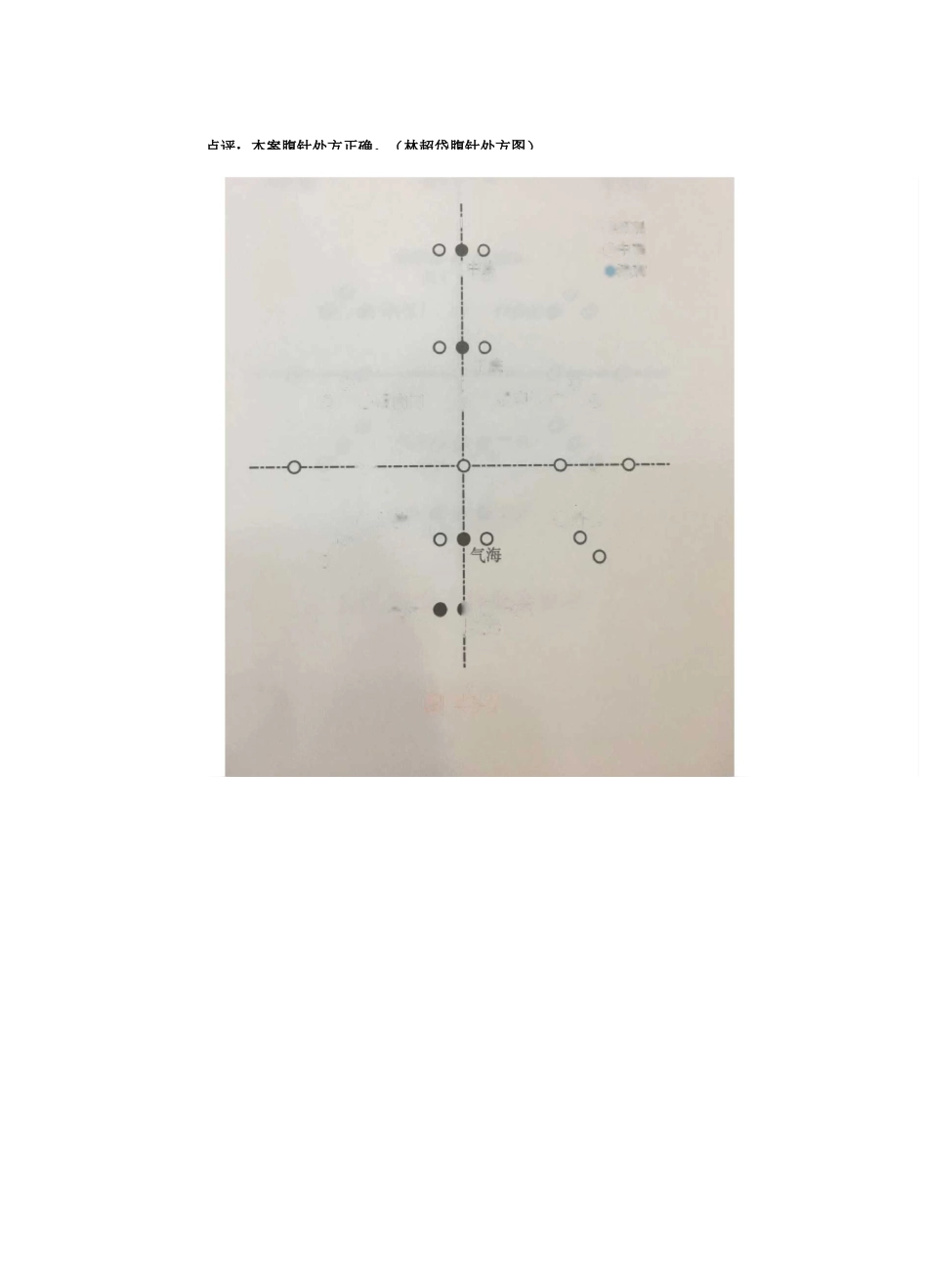 【失眠】林超岱医案点评摘抄——我的腹针学习笔记_第3页