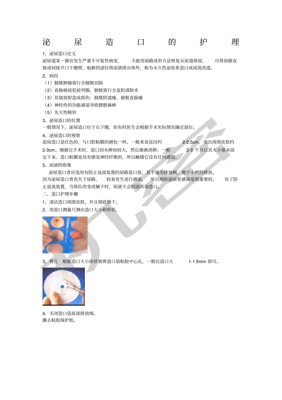 泌尿造口的护理_第1页