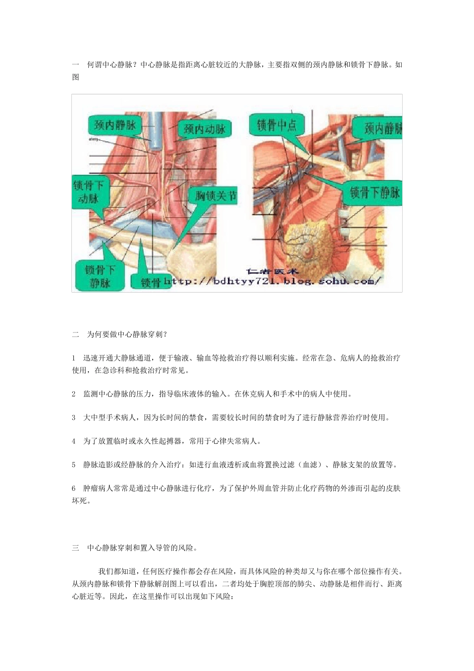 中心静脉穿刺_第1页