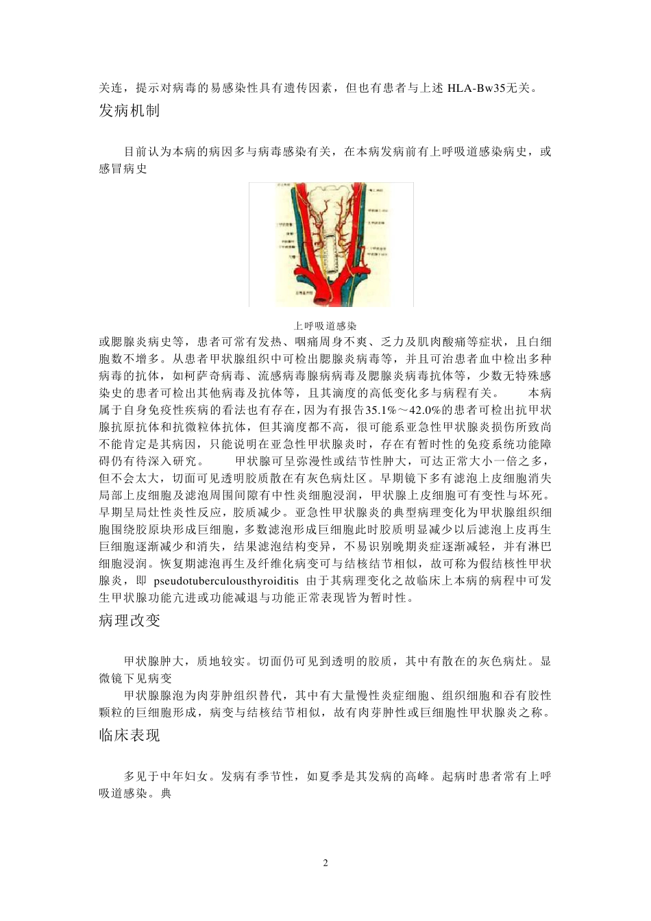 亚急性甲状腺炎_第2页