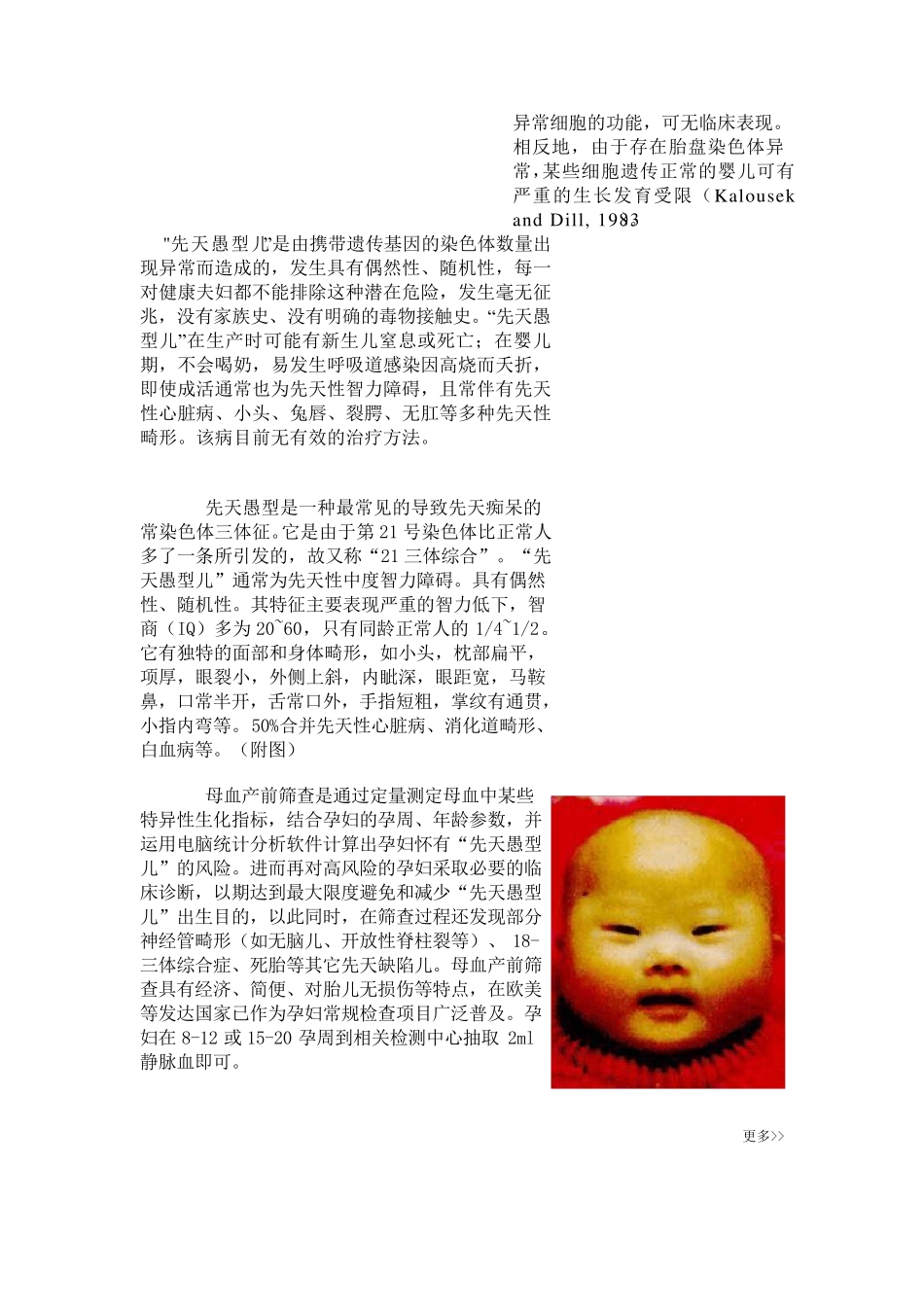 产前筛查培训讲义_第3页