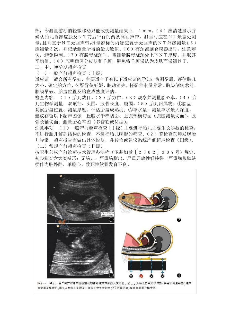 产前超声检查指南2012_第3页