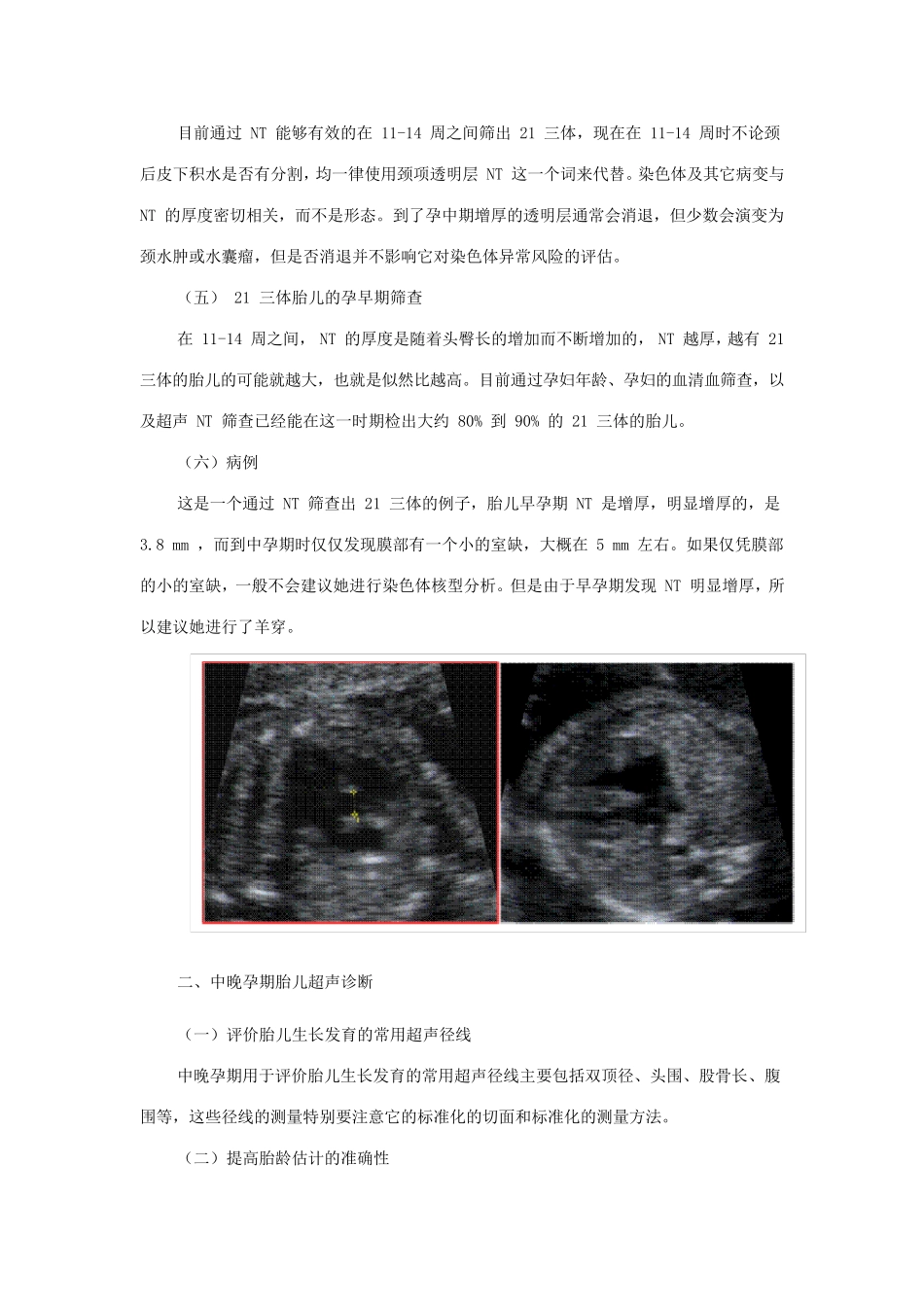 产前超声诊断_第2页