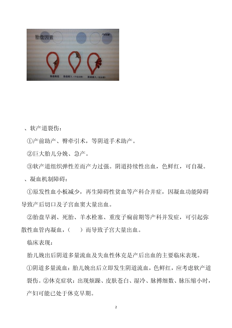 产后大出血护理查房_第2页