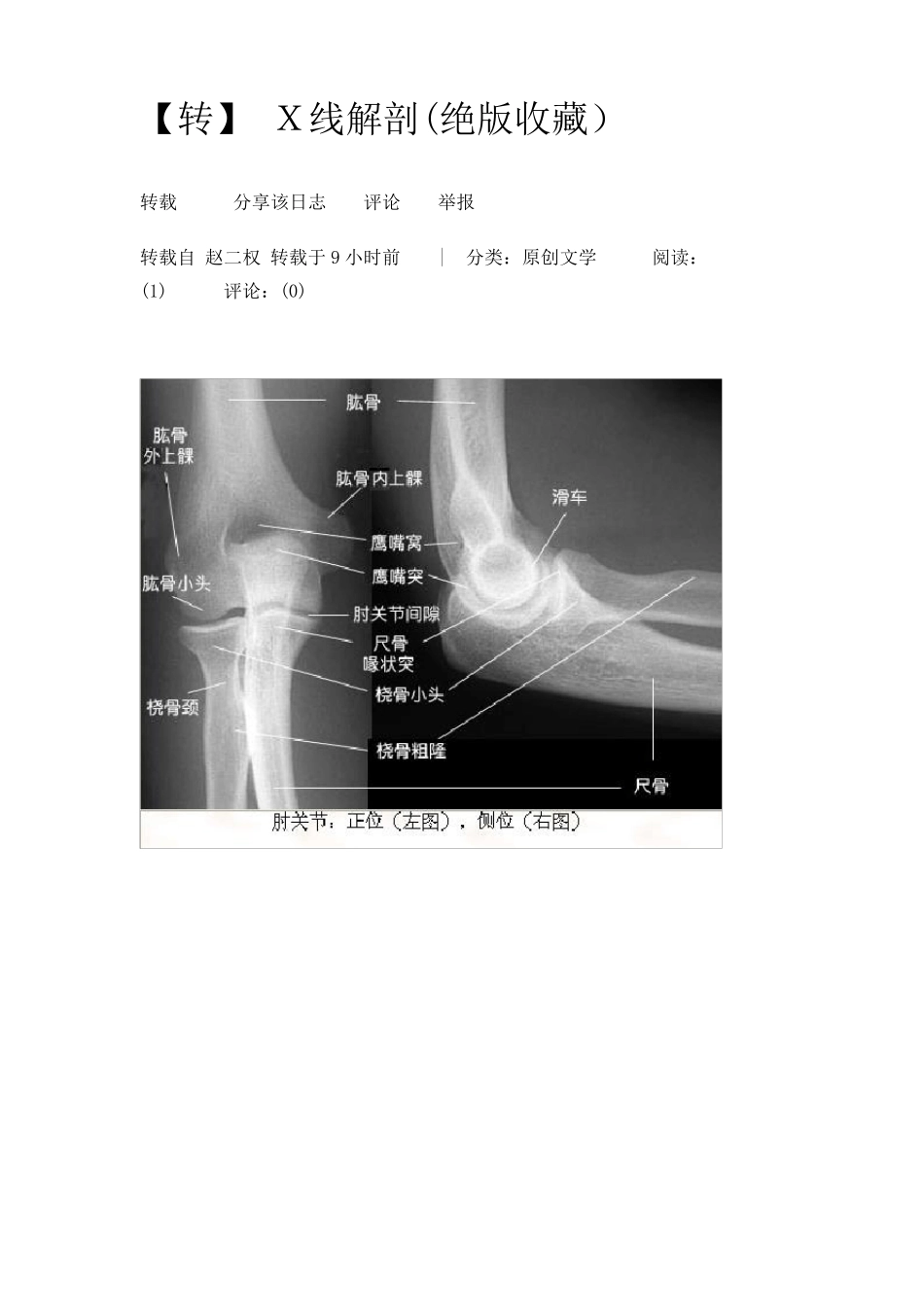 人体骨骼X线解剖_第1页