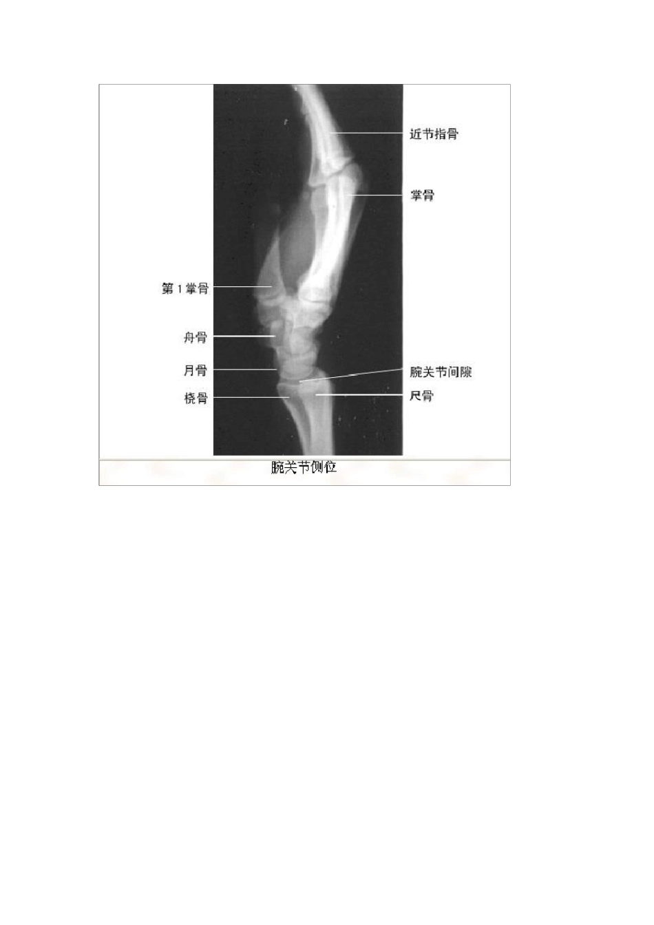 人体骨骼X线解剖_第3页