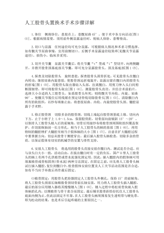 人工股骨头置换术手术步骤详解