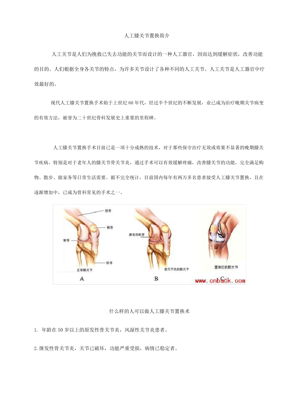 人工膝关节置换手术步骤_第1页