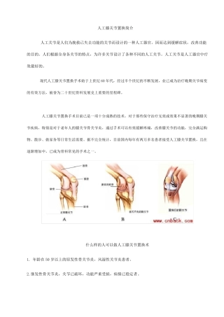 人工膝关节置换手术步骤