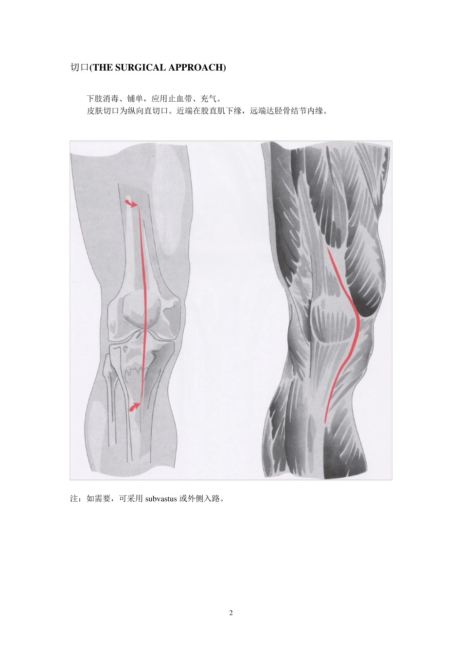 人工膝关节置换术手册(强生公司)_第3页