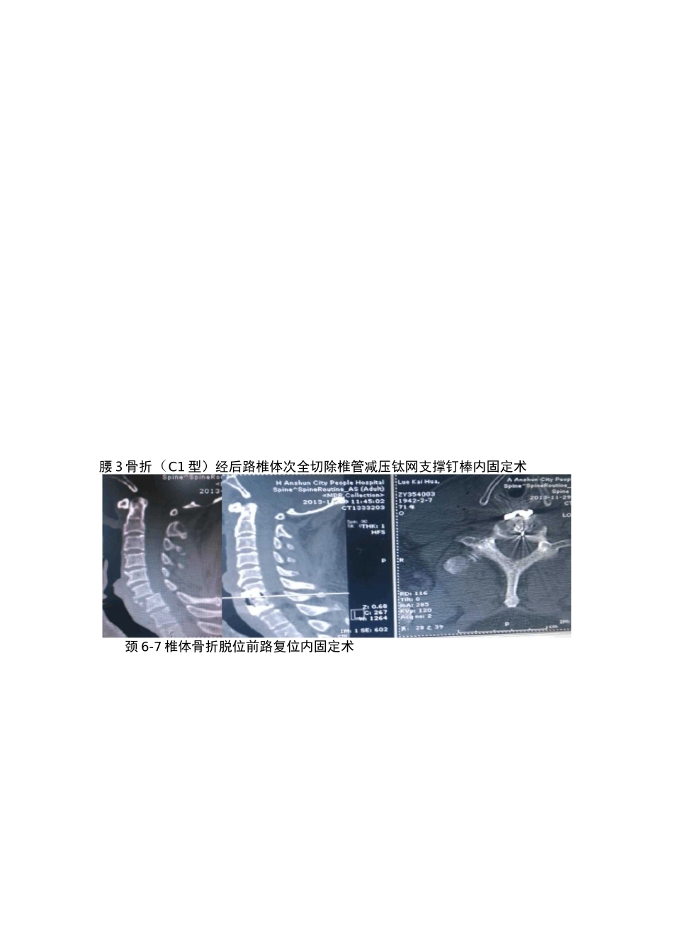 脊柱外科发展现状_第2页