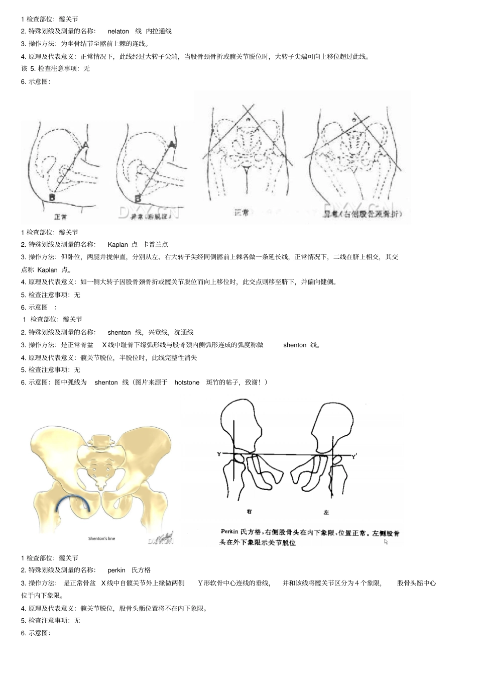 浅论骨科X线划线意义_第1页
