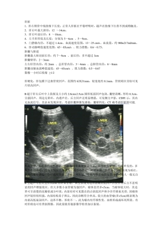 人的肝脏常见疾病超声检查