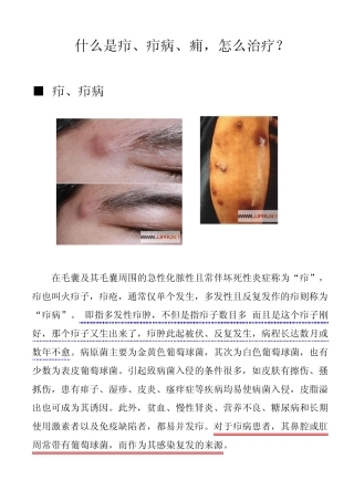 什么是疖(毛囊炎)、疖病、痈,怎么治疗